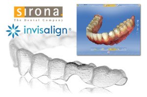 digital invisalign impressions