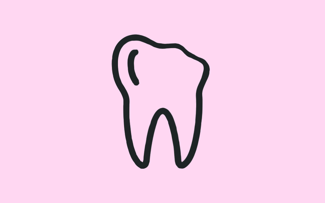 broken tooth/ Sugar Fix Dental Loft/ Sugar Fix Dental Loft