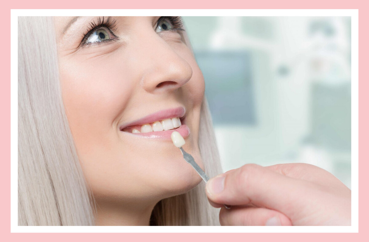 how-to-keep-your-veneers-looking-shiny-and-new