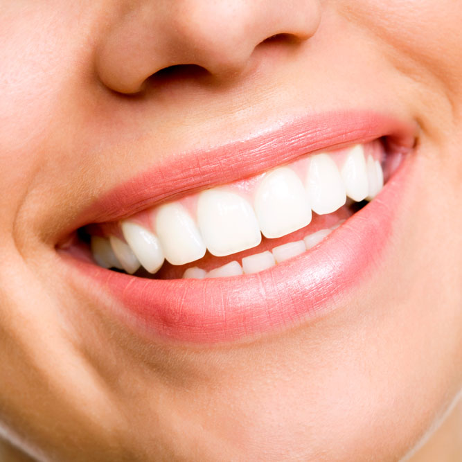 A close-up of a woman’s bright, white smile