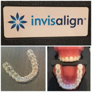 Invisalign Trays