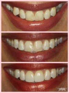 cosmetic dentistry