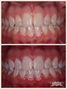 Whitening options at Sugar Fix